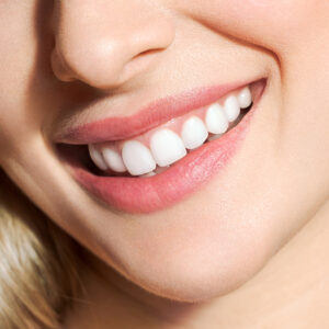 Close-up view of a woman's smile and gums